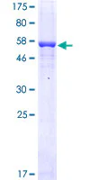 SDS-PAGE - Recombinant Human FCN1/M-Ficolin protein (GST tag N-Terminus) (AB158424)