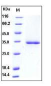 SDS-PAGE - Recombinant Human FCN1/M-Ficolin protein (His tag) (AB276340)