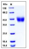 SDS-PAGE - Recombinant Human FCRL1 protein (His tag) (AB276402)