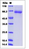 SDS-PAGE - Recombinant Human FCRL2 protein (His tag) (AB276705)
