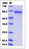 SDS-PAGE - Recombinant Human FCRL2 protein (His tag) (AB276705)