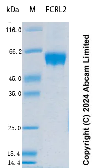 SDS-PAGE - Recombinant Human FCRL2 Protein Standard (His tag) (AB323020)