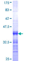 SDS-PAGE - Recombinant Human FCRL3 protein (GST tag N-Terminus) (AB165072)