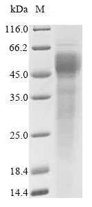 SDS-PAGE - Recombinant Human FCRL6 protein (AB267844)