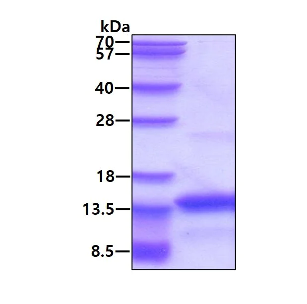 SDS-PAGE - Recombinant Human FDCSP protein (His tag N-Terminus) (AB139238)