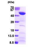 Recombinant Human FEN1 protein