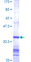 SDS-PAGE - Recombinant Human Ferredoxin Reductase protein (AB158428)