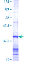 SDS-PAGE - Recombinant Human Ferredoxin Reductase protein (GST tag N-Terminus) (AB158428)