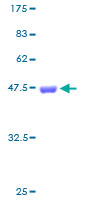SDS-PAGE - Recombinant Human Ferritin Light Chain protein (GST tag N-Terminus) (AB158473)