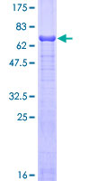SDS-PAGE - Recombinant Human Fetuin A protein (GST tag N-Terminus) (AB157872)