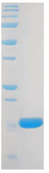 SDS-PAGE - Recombinant human FGF1 protein (AB91374)