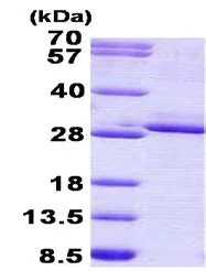 SDS-PAGE - Recombinant Human FGF17 protein (denatured) (His tag N-Terminus) (AB156316)