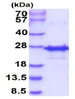 SDS-PAGE - Recombinant Human FGF21 (mutated L174P) protein (His tag N-Terminus) (AB235134)