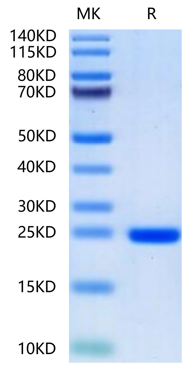 SDS-PAGE - Recombinant Human FGF8a (Active) protein (AB316037)