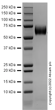 SDS-PAGE - Recombinant Human FGFR1 Protein (Active) (AB290111)