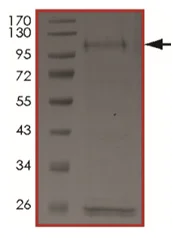 SDS-PAGE - Recombinant human FGFR1OP-FGFR1 protein (AB201397)