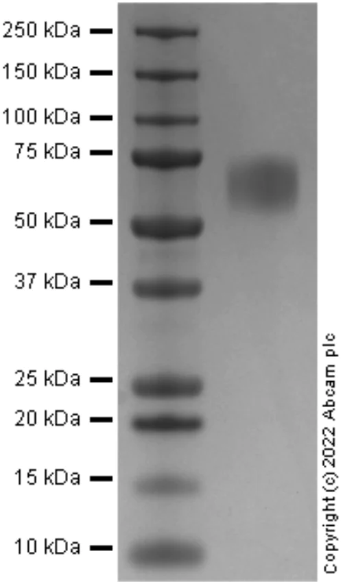 SDS-PAGE - Recombinant Human FGFR2 protein (Active) (AB287927)
