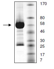 SDS-PAGE - Recombinant human FGFR4 protein (AB135023), expandable thumbnail