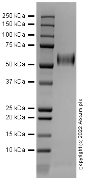 SDS-PAGE - Recombinant Human FGFR4 Protein (Active) (AB290077)