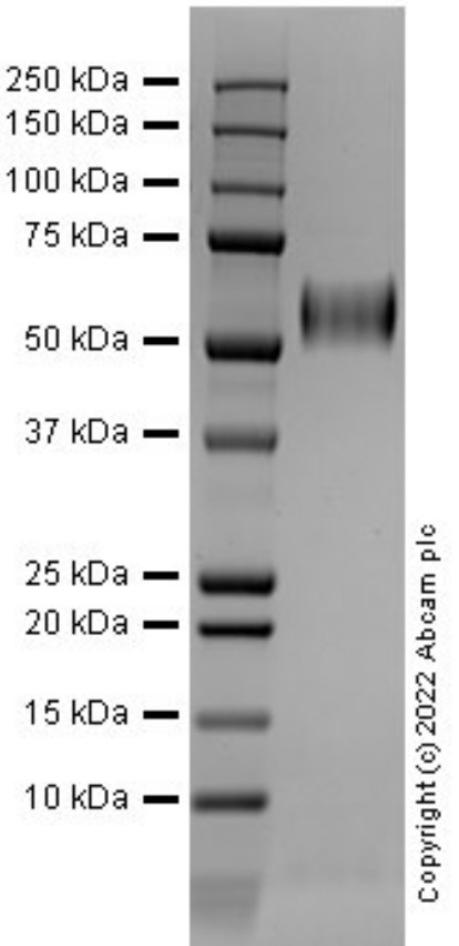 SDS-PAGE - Recombinant Human FGFR4 Protein (Active) (ab290077), expandable thumbnail