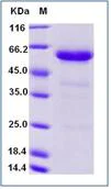 SDS-PAGE - Recombinant Human FGL1 protein (Fc Chimera) (AB276547)