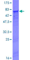SDS-PAGE - Recombinant Human FGL2/Prothrombinase protein (AB161182)