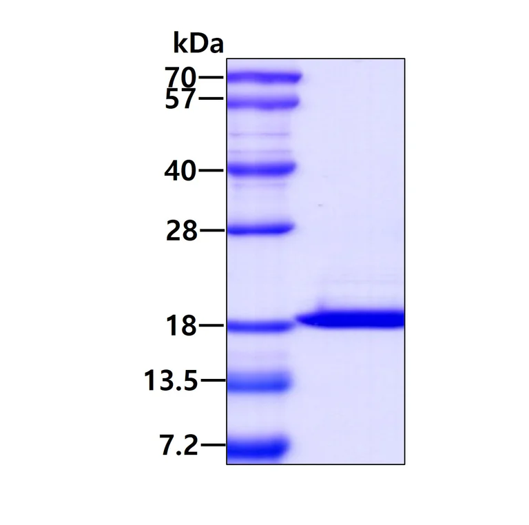 SDS-PAGE - Recombinant Human FHIT protein (His tag C-Terminus) (AB95856)