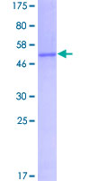 Recombinant Human FHL1 protein