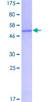 SDS-PAGE - Recombinant Human FHL1 protein (GST tag N-Terminus) (AB114384)