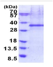 SDS-PAGE - Recombinant Human FHL2 protein (denatured) (AB187462)