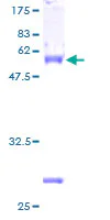 SDS-PAGE - Recombinant Human FHL2 protein (GST tag N-Terminus) (AB132098)
