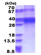 SDS-PAGE - Recombinant Human FHL3 protein (His tag N-Terminus) (AB176074)