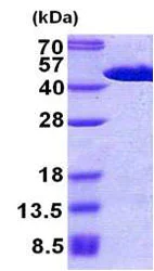 SDS-PAGE - Recombinant Human FIBP protein (His tag N-Terminus) (AB156710)