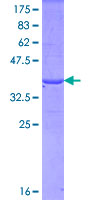 SDS-PAGE - Recombinant Human Fibrillin 1 protein (AB114345), expandable thumbnail