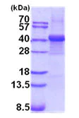 SDS-PAGE - Recombinant Human Fibrinogen beta chain protein (AB202189)