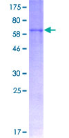 Recombinant Human Fibromodulin protein