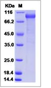 SDS-PAGE - Recombinant Human Fibromodulin protein (Fc Chimera) (AB276400)