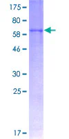 SDS-PAGE - Recombinant Human Fibromodulin protein (GST tag N-Terminus) (AB152392)