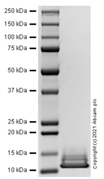 SDS-PAGE - Recombinant Human Fibronectin protein (AB283422), expandable thumbnail