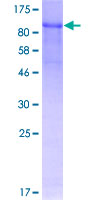 Recombinant Human Fibulin 1 protein