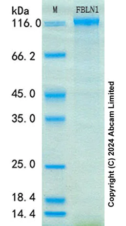 SDS-PAGE - Recombinant Human Fibulin 1 Protein Standard (His tag) (AB316687)