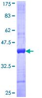 SDS-PAGE - Recombinant Human Fibulin 2 protein (AB114844)