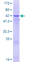 SDS-PAGE - Recombinant Human Ficolin 2 protein (AB158426)
