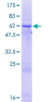 SDS-PAGE - Recombinant Human Ficolin 2 protein (GST tag N-Terminus) (AB158426)