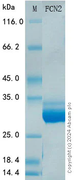 SDS-PAGE - Recombinant Human Ficolin-2 Protein Standard (His tag) (AB316520)