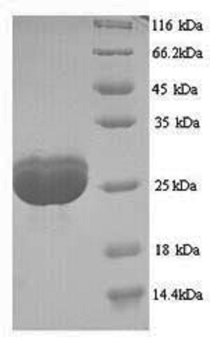 SDS-PAGE - Recombinant Human Filaggrin protein (His tag) (AB240777), expandable thumbnail