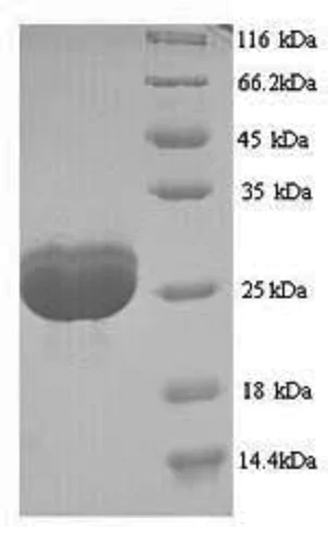 SDS-PAGE - Recombinant Human Filaggrin protein (His tag) (AB240777)