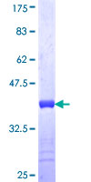 SDS-PAGE - Recombinant Human Filamin B protein (GST tag N-Terminus) (AB158452)