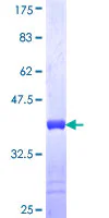 SDS-PAGE - Recombinant Human Filamin B protein (GST tag N-Terminus) (AB158452)