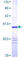 SDS-PAGE - Recombinant Human Filamin C protein (GST tag N-Terminus) (AB158453)